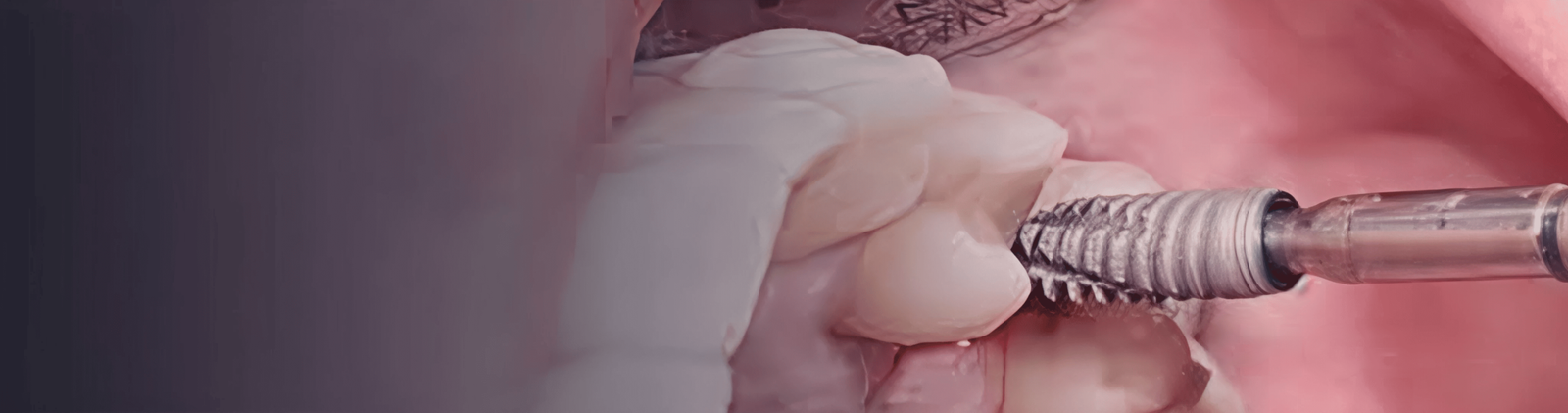 2A.png